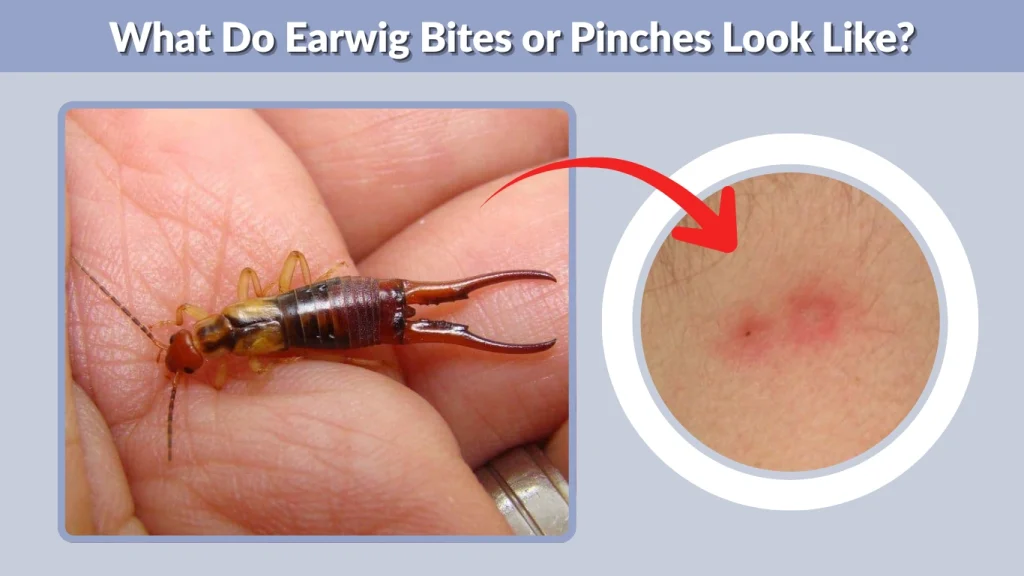 What Do Earwig Bites or Pinches Look Like