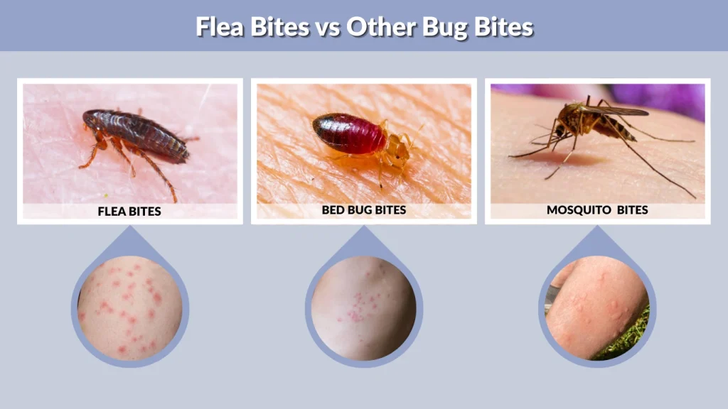 Flea Bites vs Other Bug Bites