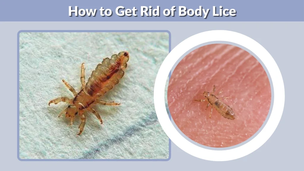 How to Get Rid of Body Lice