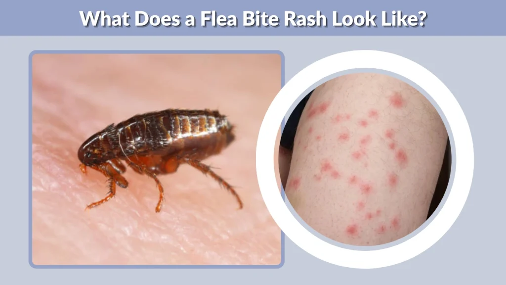 What Does a Flea Bite Rash Look Like