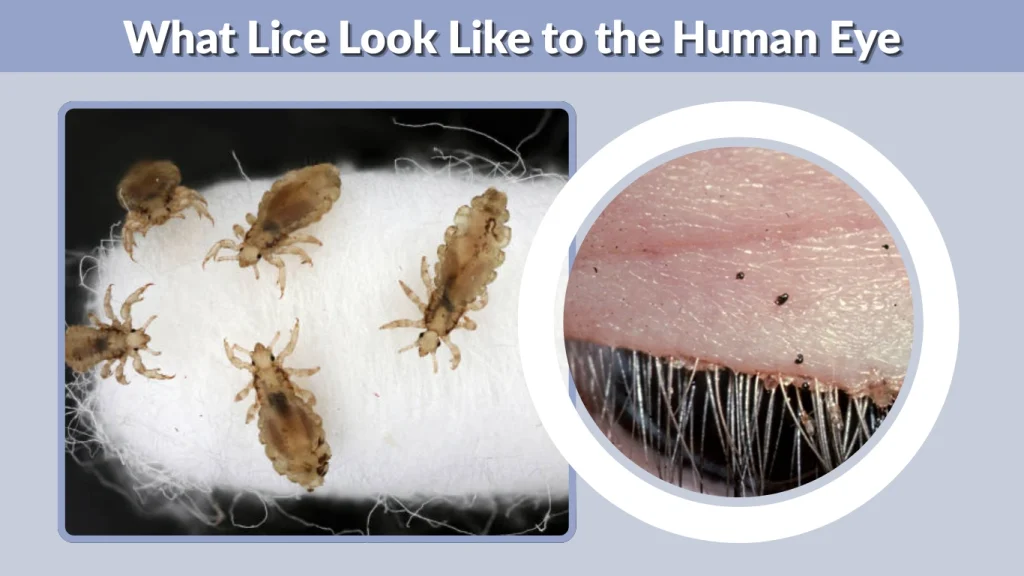 What Lice Look Like to the Human Eye
