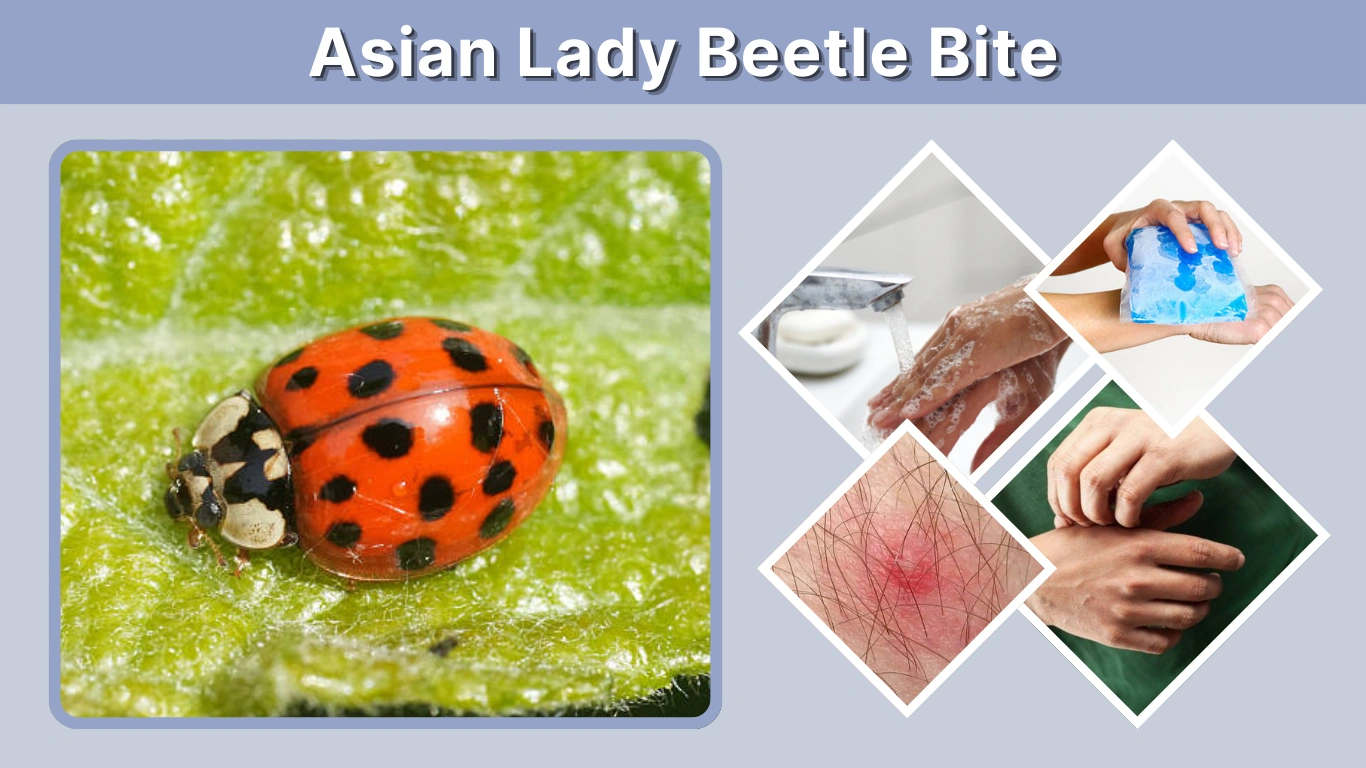 Asian Lady Beetle Bite Symptoms, Marks & Treatment