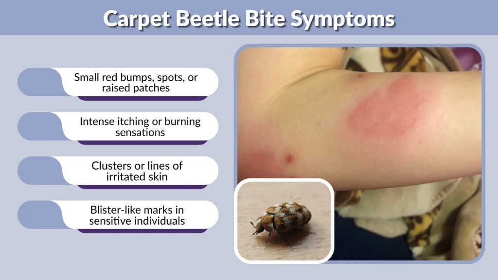 Carpet Beetle Bite Symptoms