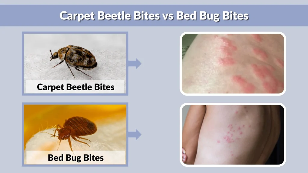 Carpet Beetle Bites vs Bed Bug Bites