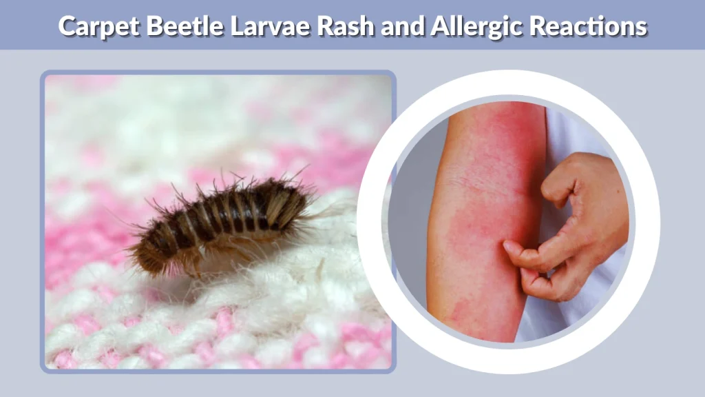 Carpet Beetle Larvae Rash and Allergic Reactions