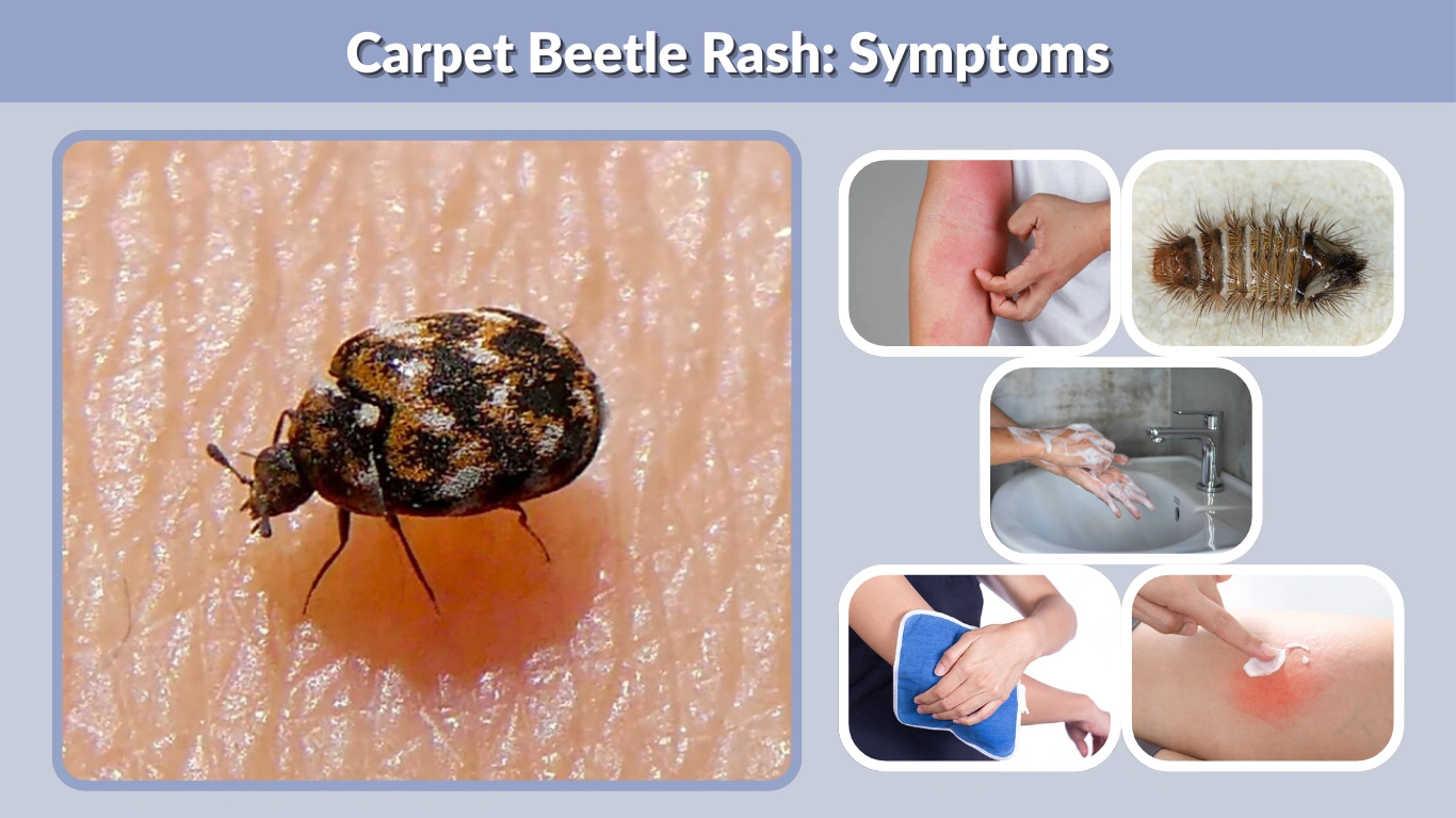 Carpet Beetle Rash: Symptoms, Pictures, Treatment &amp; Causes