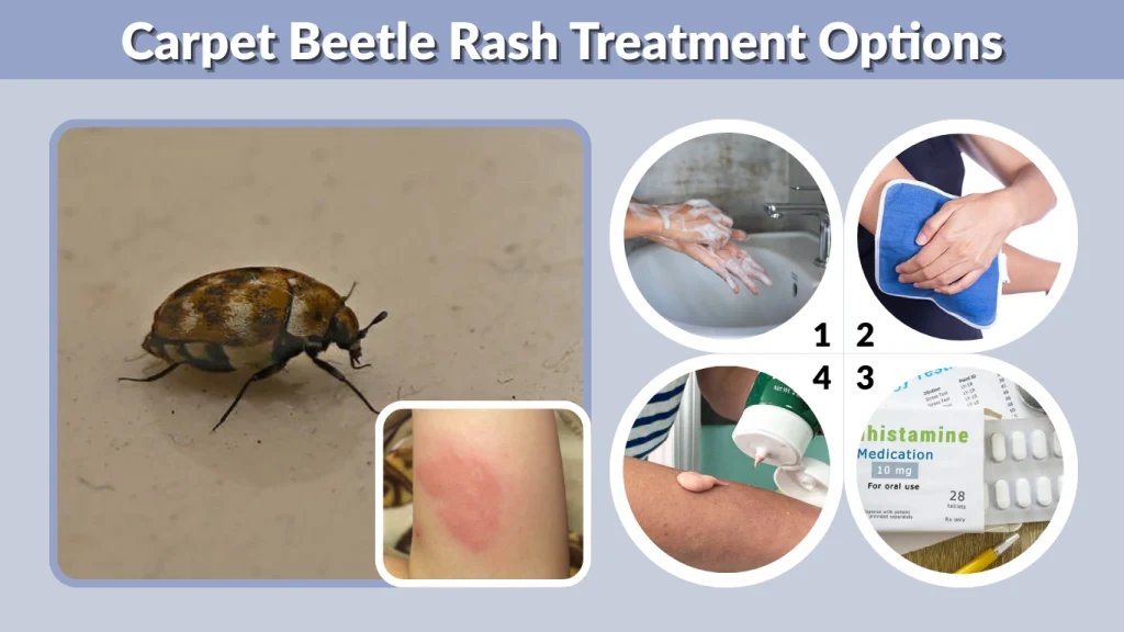Carpet Beetle Rash Treatment Options