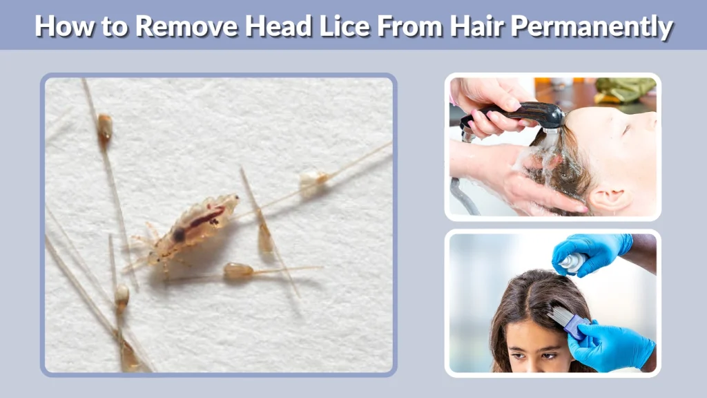 How to Remove Head Lice From Hair Permanently