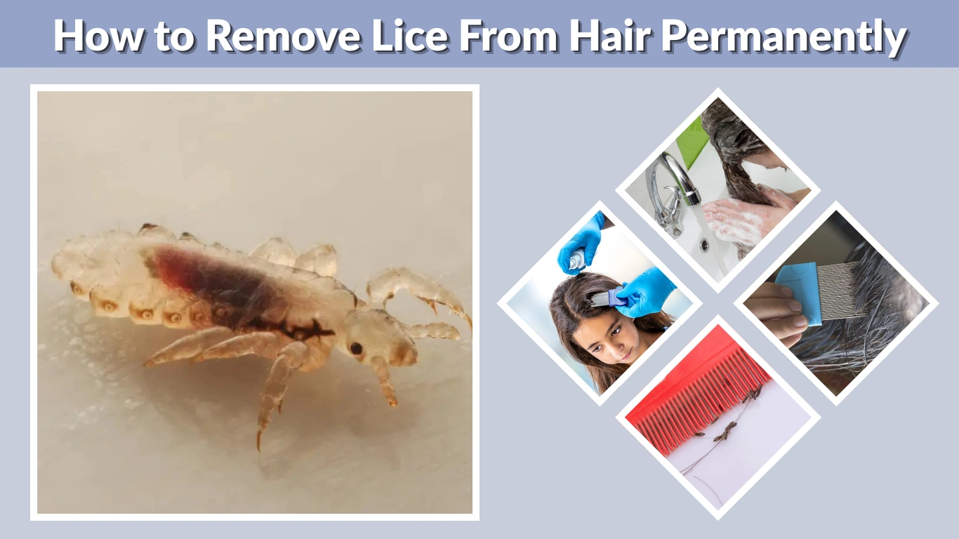 How to Remove Lice From Hair Permanently Complete Step-by-Step Guide