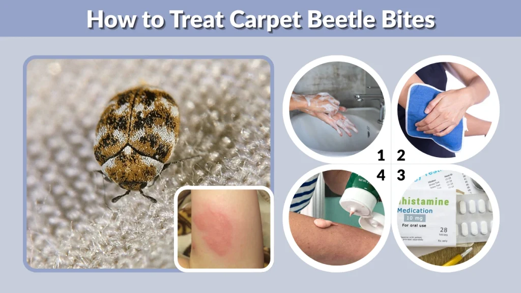 How to Treat Carpet Beetle Bites