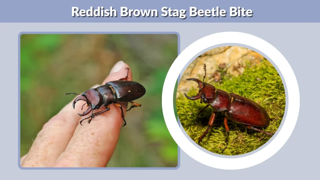 Reddish Brown Stag Beetle Bite