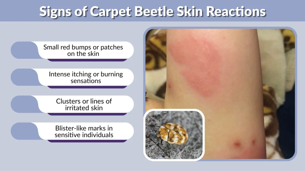 Signs of Carpet Beetle Skin Reactions