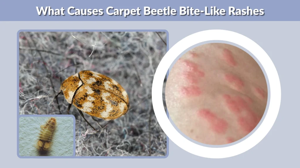 What Causes Carpet Beetle Bite-Like Rashes