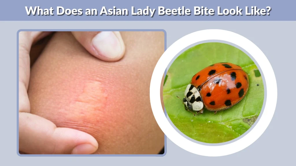 What Does an Asian Lady Beetle Bite Look Like