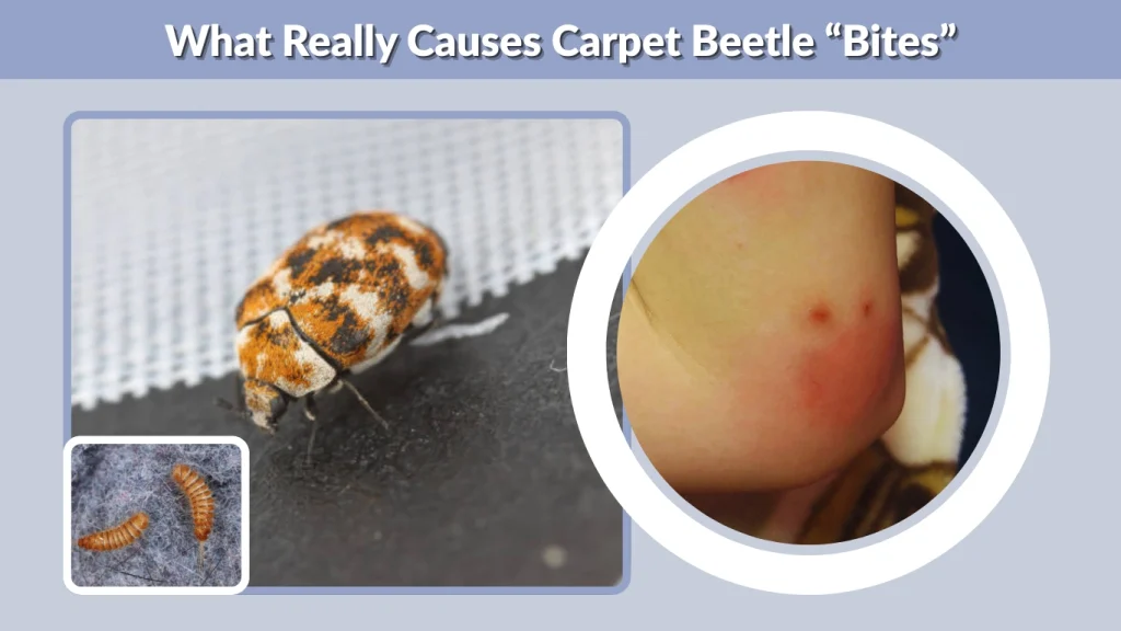 What Really Causes Carpet Beetle “Bites”
