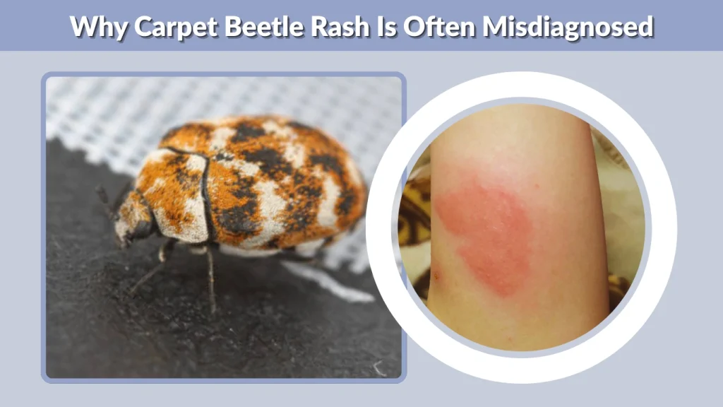 Why Carpet Beetle Rash Is Often Misdiagnosed