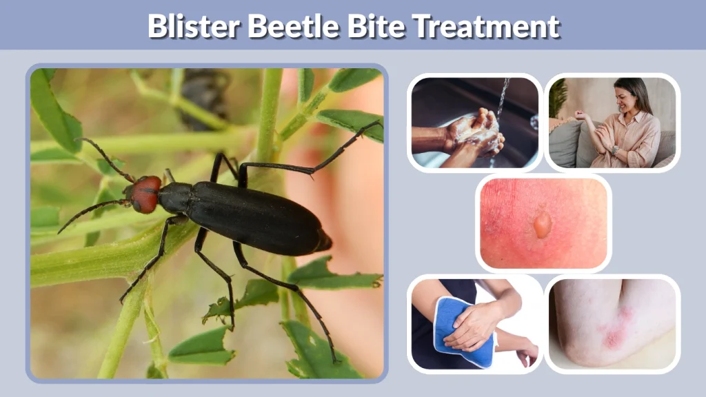 Blister Beetle Bite Treatment