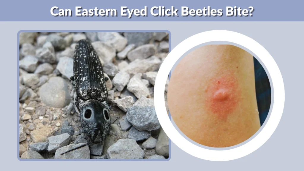 Can Eastern Eyed Click Beetles Bite