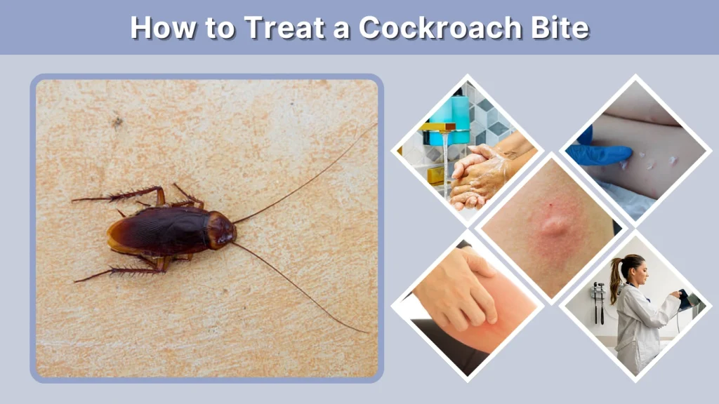 How to Treat a Cockroach Bite