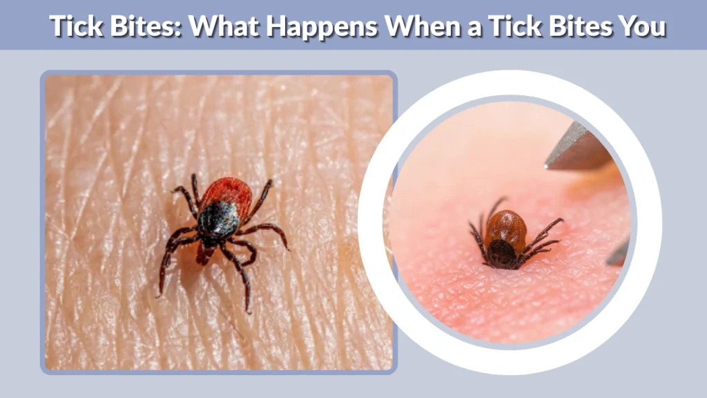 Tick Bites What Happens When a Tick Bites You
