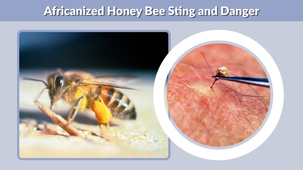 Africanized Honey Bee Sting and Danger