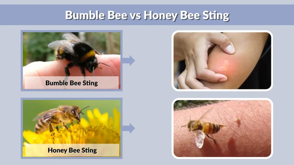 Bumble Bee vs Honey Bee Sting