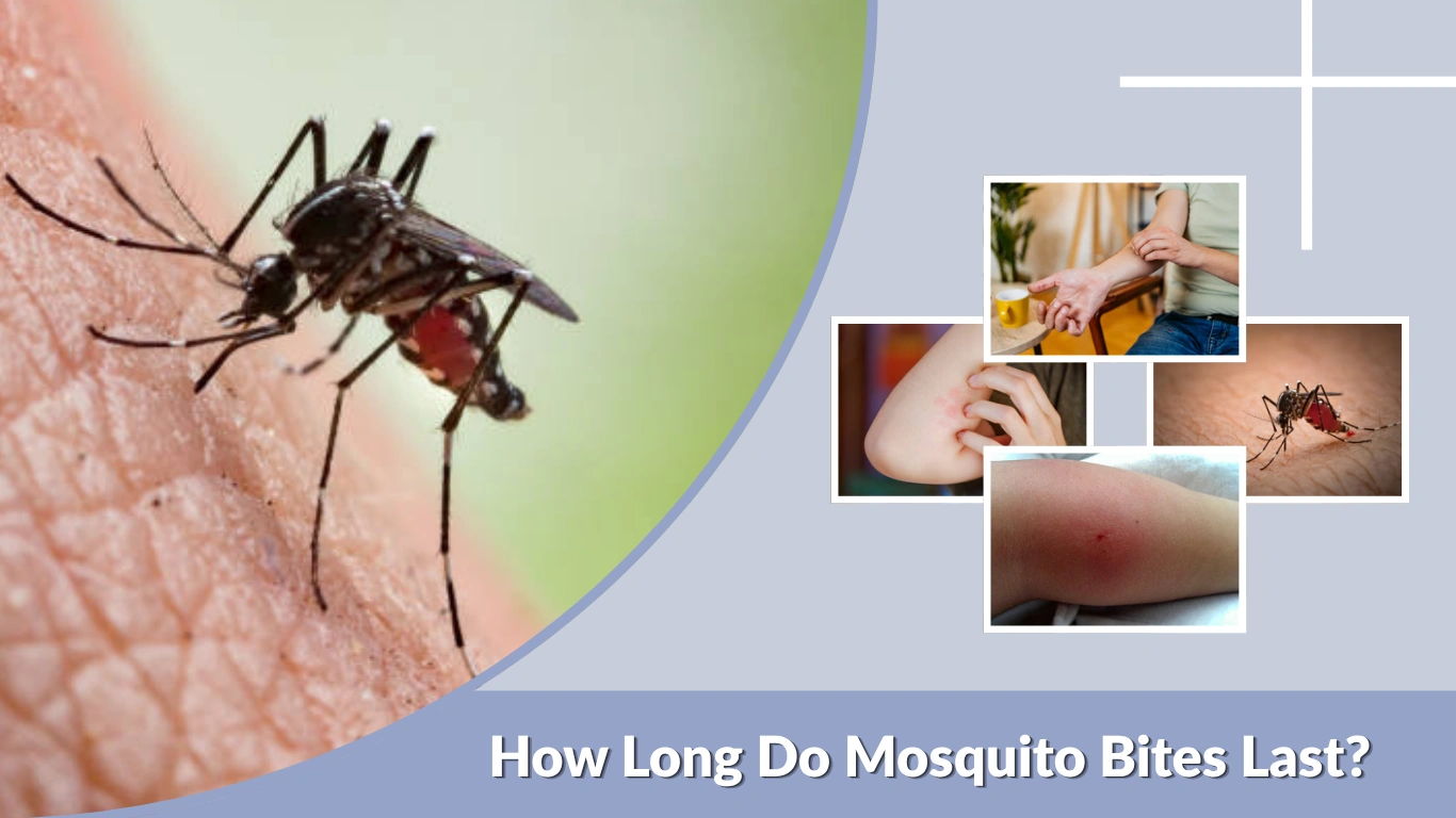How Long Do Mosquito Bites Last Complete Guide