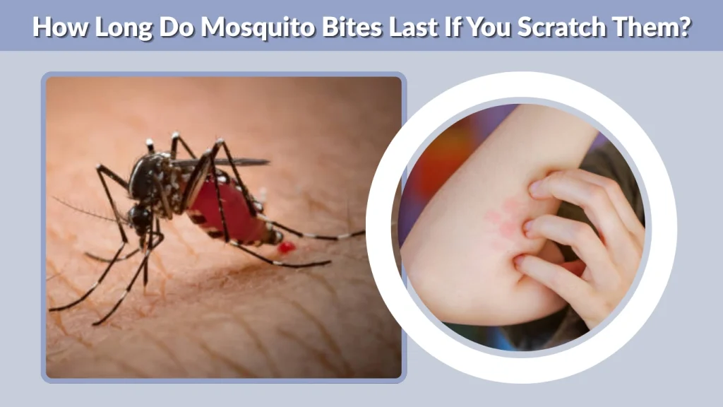 How Long Do Mosquito Bites Last If You Scratch Them