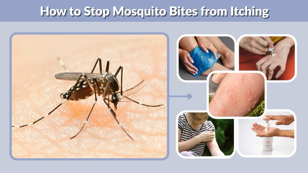 How to Stop Mosquito Bites from Itching