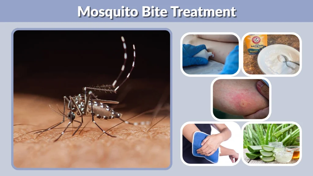 Mosquito Bite Treatment