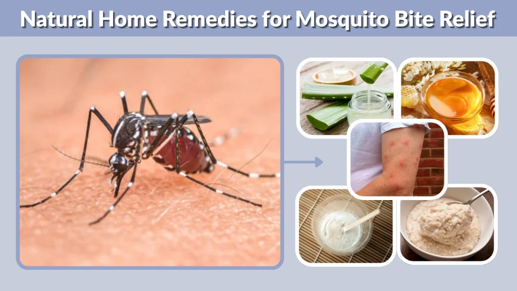 Natural Home Remedies for Mosquito Bite Relief