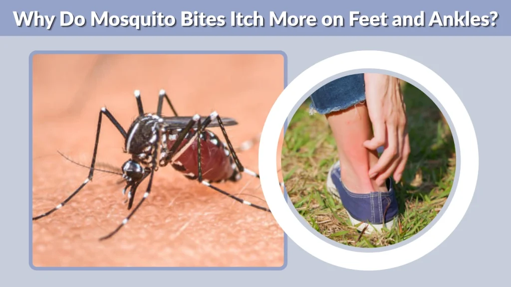 Why Do Mosquito Bites Itch More on Feet and Ankles