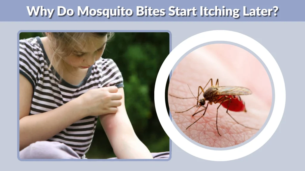Why Do Mosquito Bites Start Itching Later