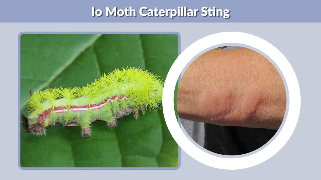 Io Moth Caterpillar Sting