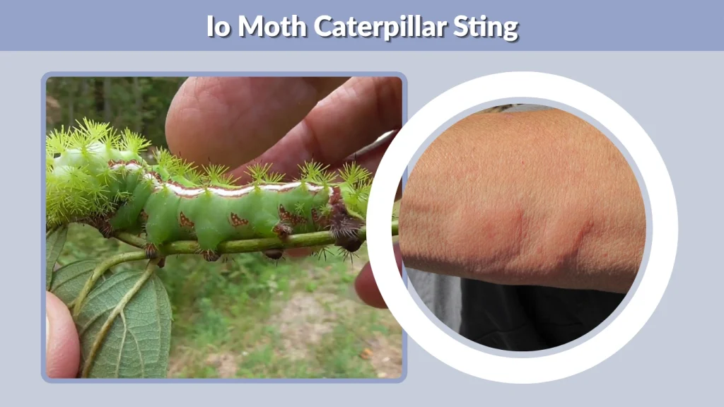 Io Moth Caterpillar Sting