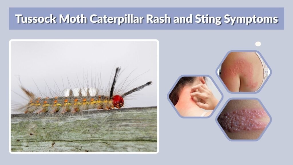 Tussock Moth Caterpillar Rash and Sting Symptoms