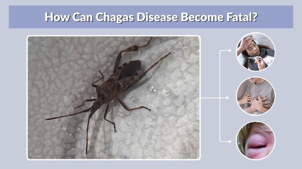 How Can Chagas Disease Become Fatal?