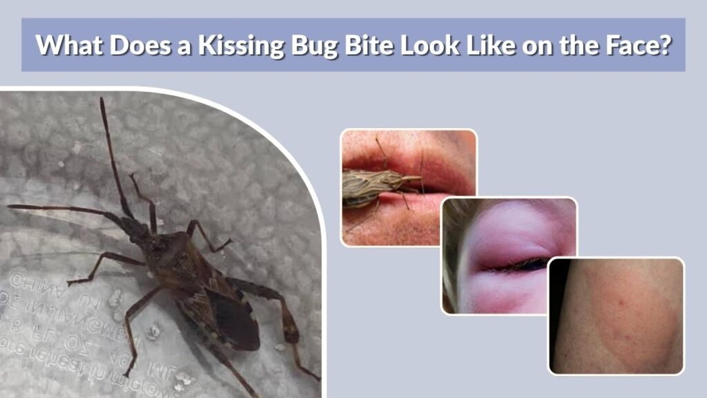 What Does a Kissing Bug Bite Look Like on the Face?