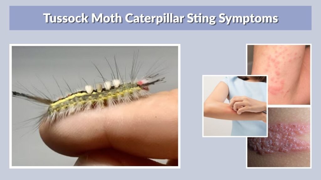 Tussock Moth Caterpillar Sting Symptoms