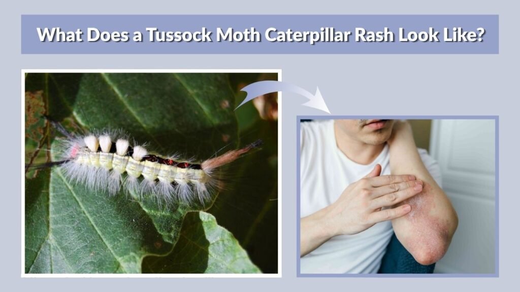 What Does a Tussock Moth Caterpillar Rash Look Like?