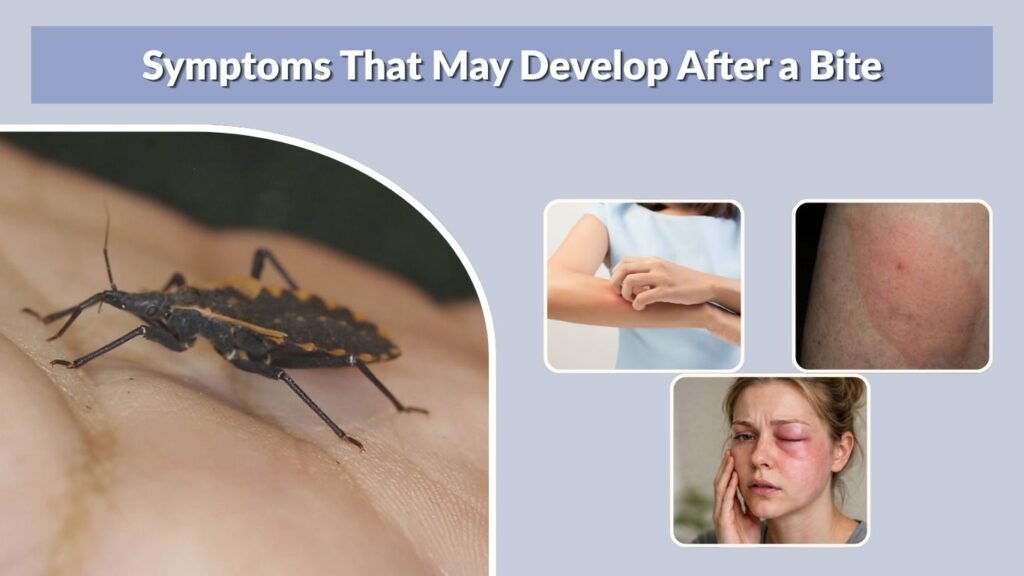 Symptoms That May Develop After a Bite