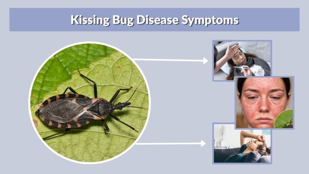 Kissing Bug Disease Symptoms