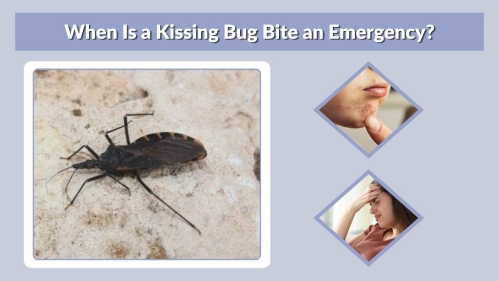 When Is a Kissing Bug Bite an Emergency?
