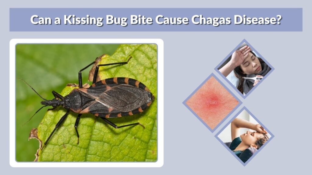 Can a Kissing Bug Bite Cause Chagas Disease?