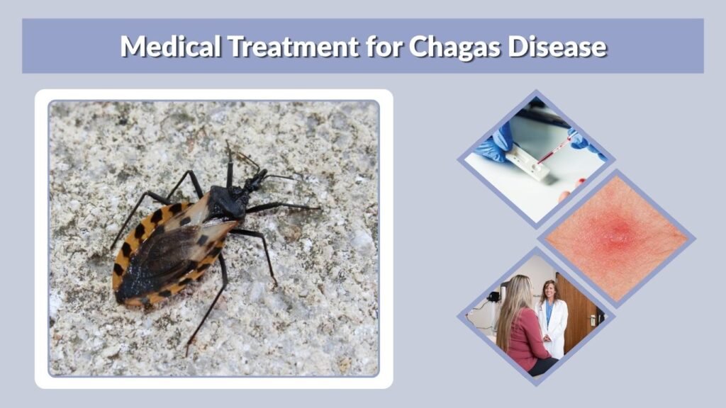 Medical Treatment for Chagas Disease