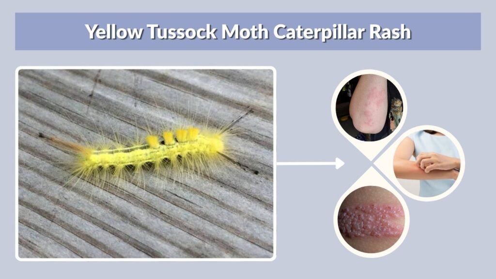 Yellow Tussock Moth Caterpillar Rash