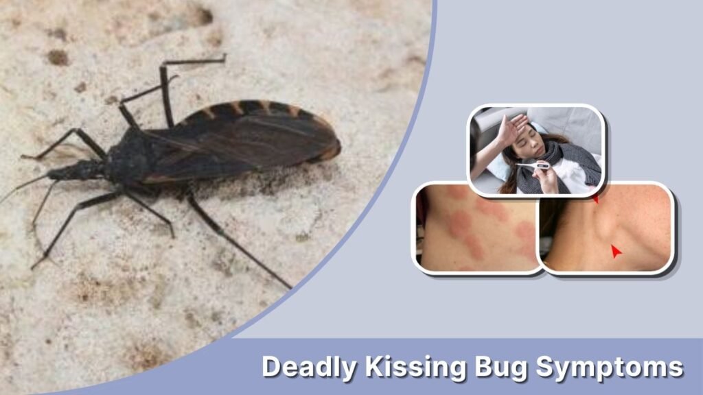 Deadly Kissing Bug Symptoms
