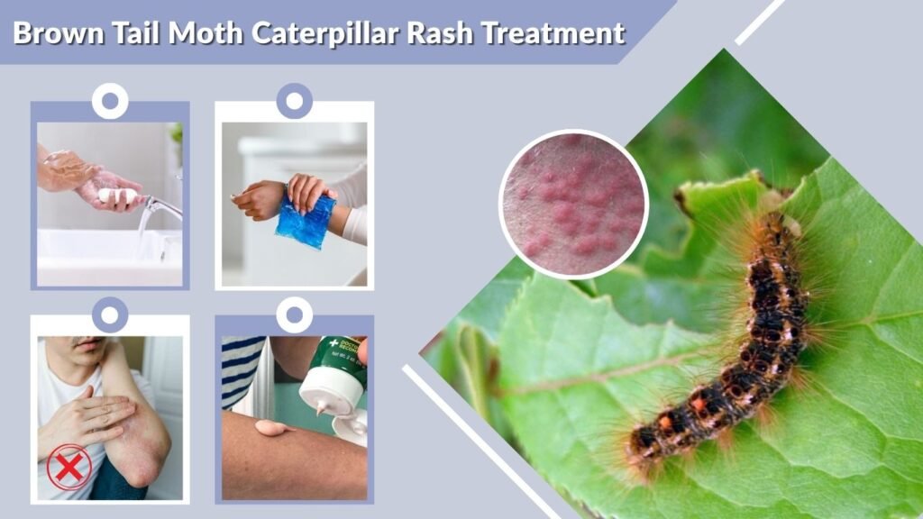 Brown Tail Moth Caterpillar Rash Treatment