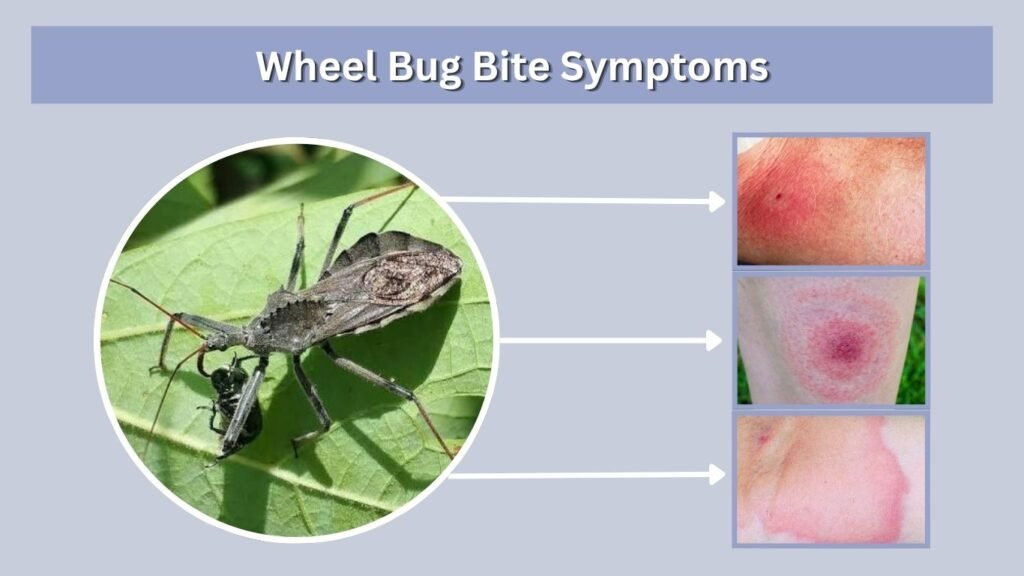 Wheel Bug Bite Symptoms