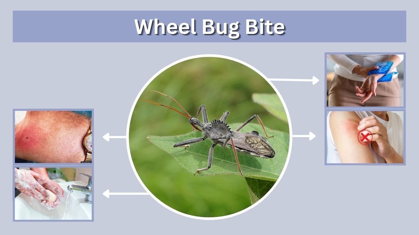 Wheel Bug Bite: Symptoms, Pain, and Treatment
